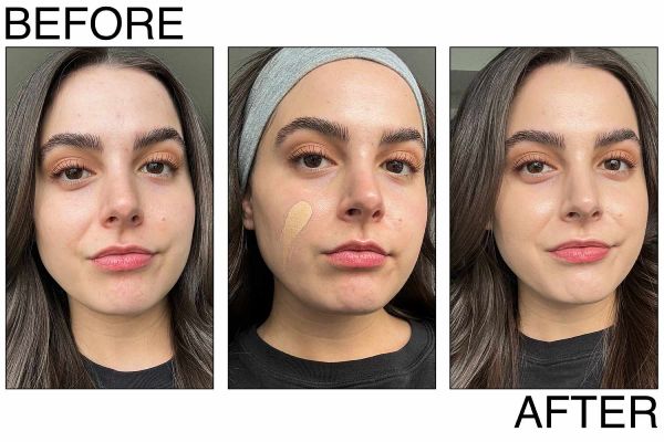 Aavikuk foundation covers acne scars