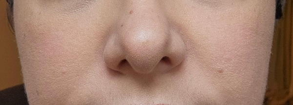 Foundation settling into pores and wrinkles