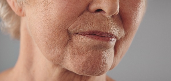 Challenges of mature skin dryness