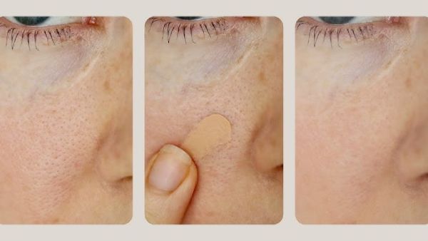 Pore-filling primer for acne scars